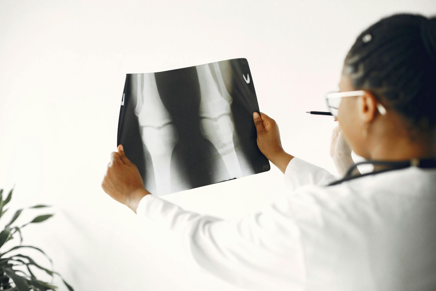 ct scan pengapuran tulang